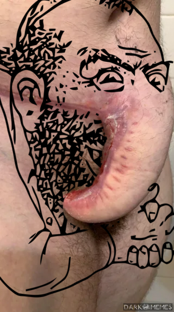 #632521009